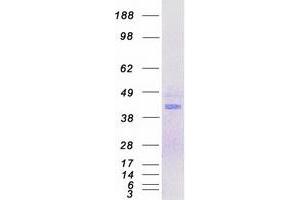 MNX1 Protein (Myc-DYKDDDDK Tag)