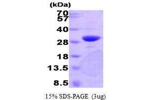 Figure annotation denotes ug of protein loaded and % gel used. (PNMT Protein (AA 1-282))