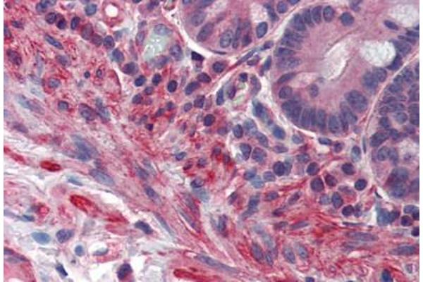 PRDM5 antibody  (AA 36-85)