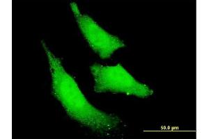 Immunofluorescence of monoclonal antibody to RNF111 on HeLa cell. (RNF111 antibody  (AA 1-108))
