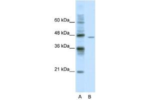 DDX25 antibody used at 0.