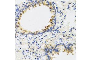 Immunohistochemistry of paraffin-embedded rat lung using UVRAG antibody. (UVRAG antibody  (AA 501-699))