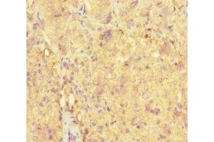 Immunohistochemistry of paraffin-embedded human adrenal gland tissue using ABIN7161000 at dilution of 1:100 (ME3 antibody  (AA 547-598))