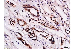 Formalin-fixed and paraffin embedded human kidney labeled with Anti-STRA6 Polyclonal Antibody, Unconjugated  at 1:200 followed by conjugation to the secondary antibody and DAB staining (STRA6 antibody  (AA 151-250))