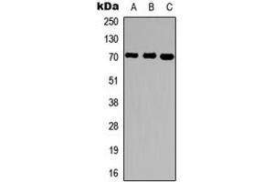 Western blot analysis of Ubiquilin 3 expression in HepG2 (A), rat brain (B), rat liver (C) whole cell lysates. (Ubiquilin 3 antibody  (Center))