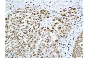 Formalin-fixed and paraffin embedded rat liver labeled with Anti-HBsAg(H2F4) Monoclonal Antibody, Unconjugated (bsm-2024M) at 1:200 followed by conjugation to the secondary antibody and DAB staining (HBSAg antibody)