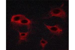 ABIN6267492 staining HepG2 cells by ICC/IF.