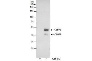 IP Image Immunoprecipitation of CEBPB protein from HeLa nuclear extracts using 5 μg of C/EBP beta antibody, Western blot analysis was performed using C/EBP beta antibody, EasyBlot anti-Rabbit IgG  was used as a secondary reagent. (CEBPB antibody  (N-Term))