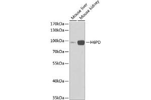 Western blot analysis of extracts of various cell lines, using H6PD Antibody (ABIN6131015, ABIN6141581, ABIN6141582 and ABIN6222086) at 1:1000 dilution. (Glucose-6-Phosphate Dehydrogenase antibody  (AA 20-200))