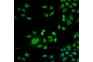 Immunofluorescence analysis of A549 cells using INTS10 Polyclonal Antibody (INTS10 antibody)
