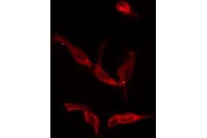 ABIN6275927 staining COLO205 by IF/ICC. (CysLTR1 antibody  (Internal Region))