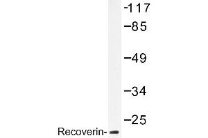 Image no. 1 for anti-Recoverin (RCVRN) antibody (ABIN272183) (Recoverin antibody)