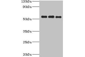 Western blot All lanes: PDHX antibody at 6 μg/mL Lane 1: 293T whole cell lysate Lane 2: PC-3 whole cell lysate Lane 3: MCF-7 whole cell lysate Secondary Goat polyclonal to rabbit IgG at 1/10000 dilution Predicted band size: 55, 30, 52 kDa Observed band size: 55 kDa