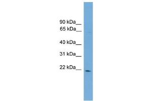 Human COLO205; WB Suggested Anti-D4S234E Antibody Titration: 0. (NSG1 antibody  (N-Term))