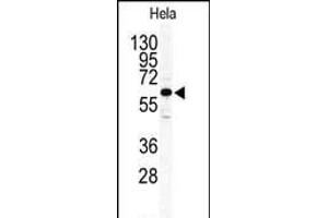 Western blot analysis of anti-ILK2/ILK1 Antibody (C-term) (ABIN391105 and ABIN2837942) in Hela cell line lysates (35 μg/lane). (ILK antibody  (C-Term))