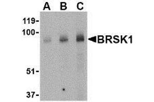 Western blot analysis of BRSK1 in human brain tissue lysate with AP30167PU-N BRSK1 antibody at (A) 0. (BRSK1 antibody  (Center))