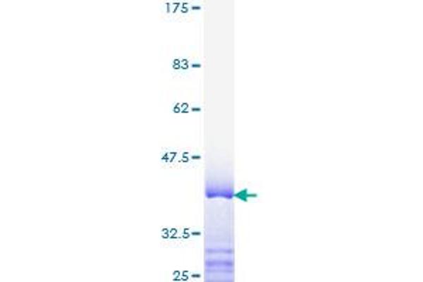 MED1 Protein (AA 1391-1490) (GST tag)