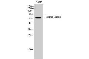 Western Blotting (WB) image for anti-Lipase, Hepatic (LIPC) (Internal Region) antibody (ABIN3175476) (LIPC antibody  (Internal Region))
