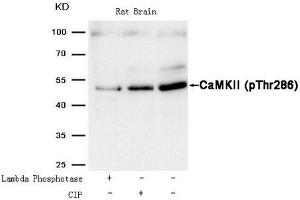 Western blot analysis of extracts from Rat brain tissue treated with Lambda Phosphotase or calf intestinal phosphatase (CIP),using CaMKII (Phospho-Thr286) Antibody. (CAMK2A antibody  (pThr286))