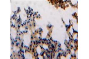 Used in DAB staining on fromalin fixed paraffin-embedded Lung tissue (ESM1 antibody  (AA 20-184))