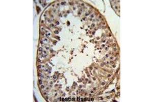 Immunohistochemistry (IHC) image for anti-Angel Homolog 1 (ANGEL1) antibody (ABIN3003977) (ANGEL1 antibody)