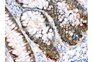 Immunohistochemistry (Paraffin-embedded Sections) (IHC (p)) image for anti-Isocitrate Dehydrogenase 1 (NADP+), Soluble (IDH1) (AA 381-413), (C-Term) antibody (ABIN3043855)