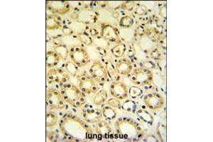 H6PD Antibody IHC analysis in formalin fixed and paraffin embedded lung tissue followed by peroxidase conjugation of the secondary antibody and DAB staining. (Glucose-6-Phosphate Dehydrogenase antibody  (C-Term))