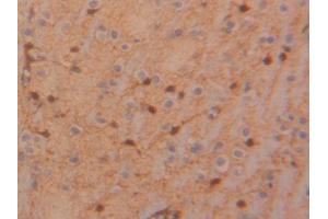 DAB staining on IHC-P; Samples: Rat Glioma Tissue (TIMP4 antibody  (AA 40-224))