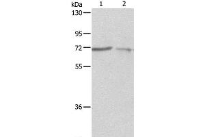 Western Blot analysis of A375 and A431 cell using SH-PTP1 Polyclonal Antibody at dilution of 1:500 (SHP1 antibody)