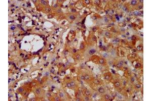 IHC image of ABIN7155245 diluted at 1:200 and staining in paraffin-embedded human liver tissue performed on a Leica BondTM system. (HAL antibody  (AA 36-152))
