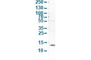 Western Blot analysis of human cell line SK-BR-3. (S100A9 antibody  (AA 3-100))