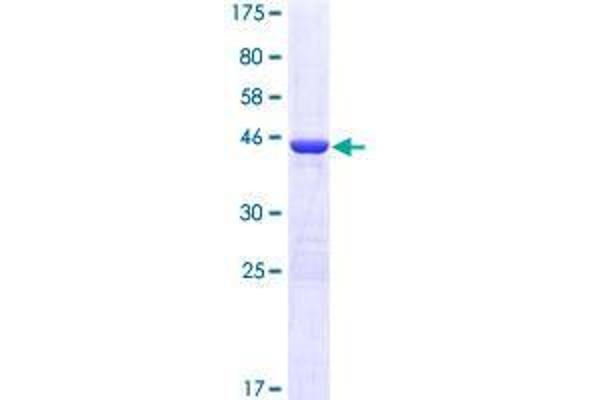 EIF5A2 Protein (AA 1-153) (GST tag)