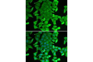 Immunofluorescence analysis of MCF-7 cells using RFFL antibody (ABIN6292254). (RFFL antibody)