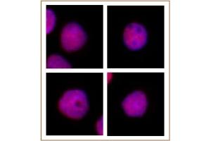 CAF-1 p60 antibody (mAb) tested by immunofluorescence. (CHAF1B antibody)