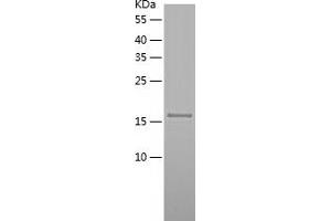 Western Blotting (WB) image for Glutathione Peroxidase 2 (GPX2) (AA 41-190) protein (His tag) (ABIN7123128) (Glutathione Peroxidase 2 Protein (GPX2) (AA 41-190) (His tag))