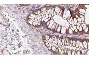 ABIN6272969 at 1/100 staining Mouse colon tissue by IHC-P. (NOD2 antibody  (N-Term))