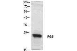 Western Blotting (WB) image for anti-Regulator of G-Protein Signaling 1 (RGS1) (Internal Region) antibody (ABIN3181413) (RGS1 antibody  (Internal Region))