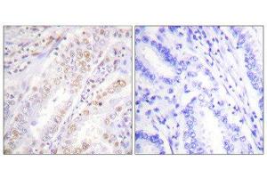 Immunohistochemistry (IHC) image for anti-X-Ray Repair Complementing Defective Repair in Chinese Hamster Cells 2 (XRCC2) (C-Term) antibody (ABIN1848896) (XRCC2 antibody  (C-Term))