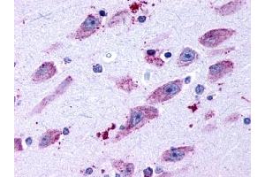 Immunohistochemical staining of Brain (Neurons and glia) using anti- DRD4 antibody ABIN122473 (DRD4 antibody  (C-Term))