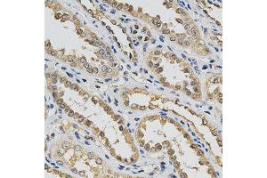 Immunohistochemistry of paraffin-embedded human kidney using EIF4E antibody at dilution of 1:200 (x400 lens) (EIF4E antibody  (AA 1-100))