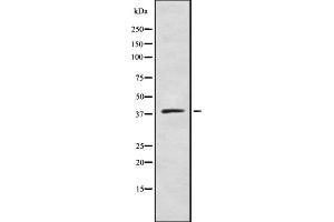 ZDHHC9 antibody  (C-Term)