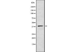 Western blot analysis of DHHC-9 using COLO205 whole cell lysates (ZDHHC9 antibody  (C-Term))
