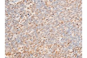 ABIN6267072 at 1/100 staining human seminoma tissue sections by IHC-P.