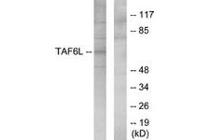 Western blot analysis of extracts from 293 cells, using TAF6L Antibody.