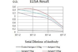 Black line: Control Antigen (100 ng),Purple line: Antigen (10 ng), Blue line: Antigen (50 ng), Red line:Antigen (100 ng) (ZAP70 antibody  (AA 169-390))