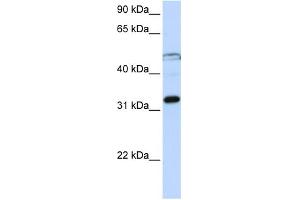 WB Suggested Anti-EIF3G Antibody Titration:  0. (EIF3G antibody  (Middle Region))