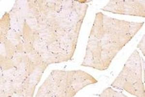 Immunohistochemistry analysis of paraffin-embedded rat skeletal muscle using,TTL (ABIN7076048) at dilution of 1: 4000 (TTL antibody)