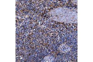 IHC analysis of Septin 11/SEPTIN11 using anti-Septin 11/SEPTIN11 antibody (ABIN7602925). (Septin 11 antibody  (C-Term))