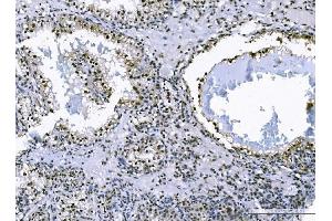 IHC analysis of FOXK1 using anti-FOXK1 antibody (ABIN7600295). (Foxk1 antibody  (AA 175-671))
