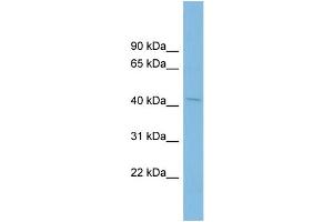 WB Suggested Anti-PTPN2 Antibody Titration: 0. (PTPN2 antibody  (N-Term))